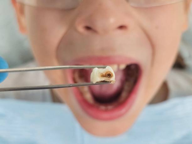 Best Tooth Pain Emergency Relief  in Ke Providence, LA